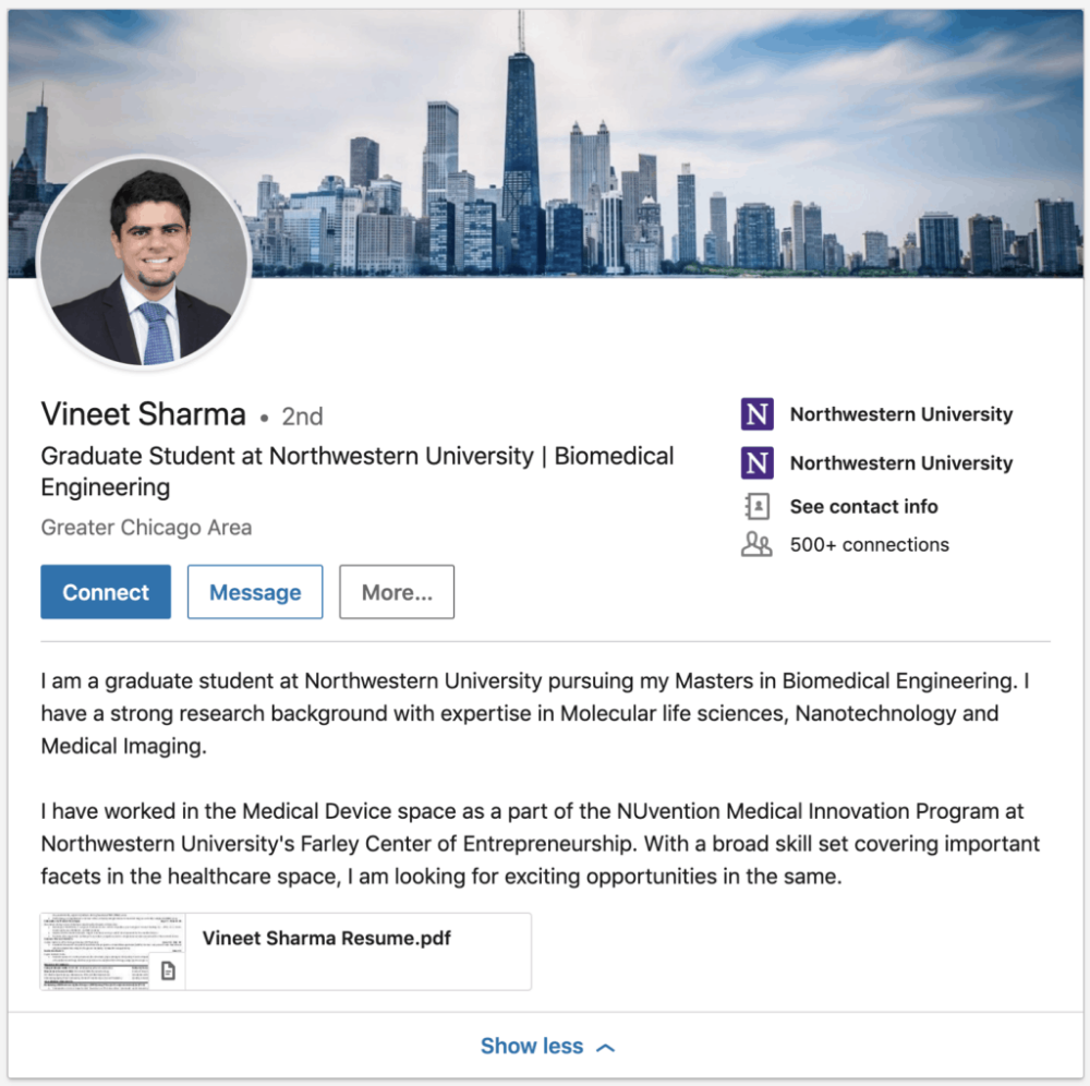 Linkedin Profile Examples For Freshers